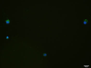 SCNN1B Rabbit Polyclonal Antibody