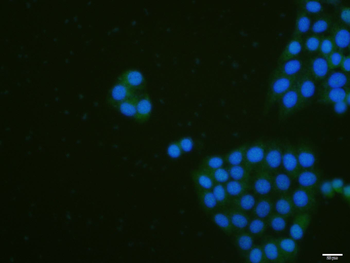 Phospho-SCNN1B (Thr615) Rabbit Polyclonal Antibody