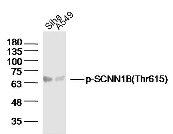 Phospho-SCNN1B (Thr615) Rabbit Polyclonal Antibody