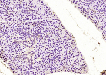 Phospho-Bcl-2 (Thr129) Rabbit Polyclonal Antibody