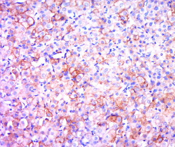 Phospho-Bcl-2 (Thr129) Rabbit Polyclonal Antibody