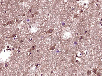 Phospho-Bad (Ser118) Rabbit Polyclonal Antibody