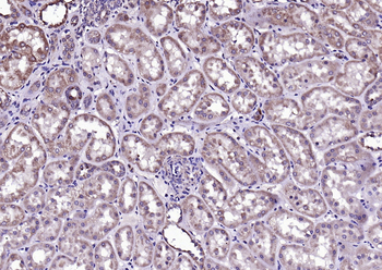 Phospho-Bad (Ser118) Rabbit Polyclonal Antibody