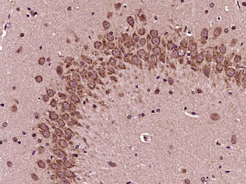 Phospho-Bad (Ser118) Rabbit Polyclonal Antibody