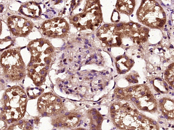 Phospho-BAD (Ser99) Rabbit Polyclonal Antibody