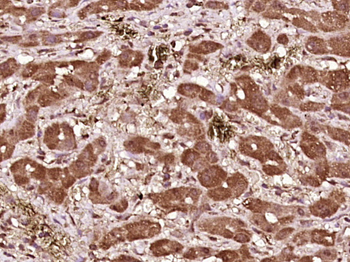 Phospho-BAD (Ser99) Rabbit Polyclonal Antibody