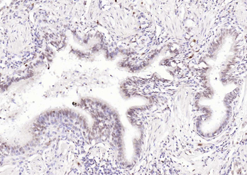 Bcl-6 Rabbit Polyclonal Antibody