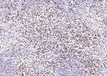 Bcl-6 Rabbit Polyclonal Antibody