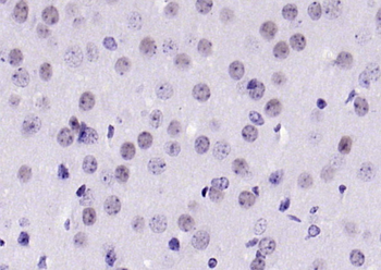 Phospho-Bcl-xL (Thr115) Rabbit Polyclonal Antibody