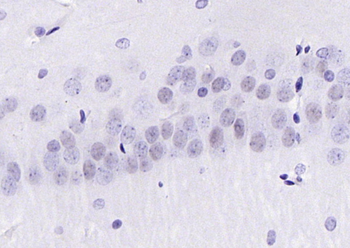 Phospho-Bcl-xL (Thr115) Rabbit Polyclonal Antibody