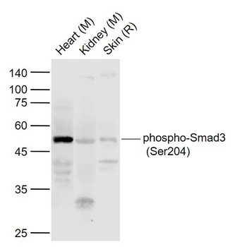 Phospho-Smad3 (Ser204) Rabbit Polyclonal Antibody