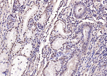 Phospho-Smad3 (Ser204) Rabbit Polyclonal Antibody