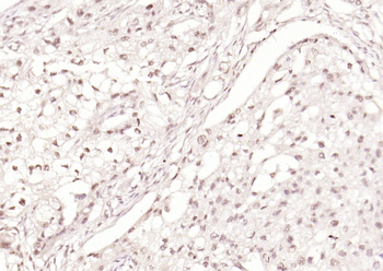 Phospho-Smad3 (Ser204) Rabbit Polyclonal Antibody