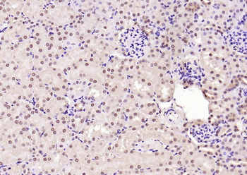 Phospho-Smad3 (Ser204) Rabbit Polyclonal Antibody