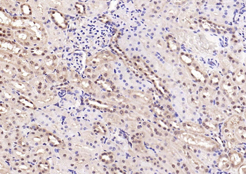 Phospho-Smad3 (Ser204) Rabbit Polyclonal Antibody