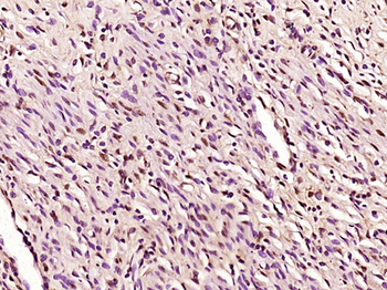 Phospho-Smad3 (Ser204) Rabbit Polyclonal Antibody