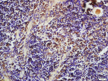 Phospho-Bim (Ser87) Rabbit Polyclonal Antibody