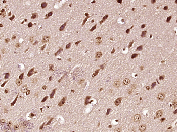 ProBNP Rabbit Polyclonal Antibody