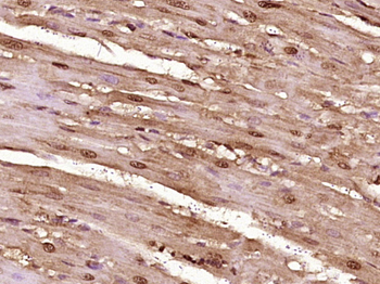ProBNP Rabbit Polyclonal Antibody
