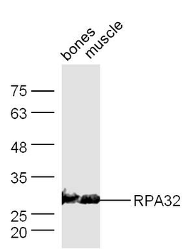 RPA2 Rabbit Polyclonal Antibody