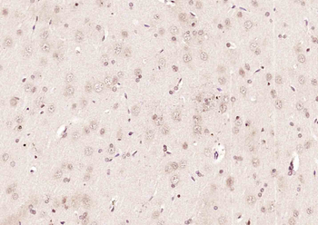 Phospho-RPA2 (Thr21) Rabbit Polyclonal Antibody