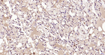 PSME3 Rabbit Polyclonal Antibody