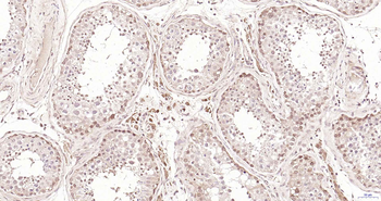 PSME3 Rabbit Polyclonal Antibody