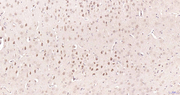 PSME3 Rabbit Polyclonal Antibody
