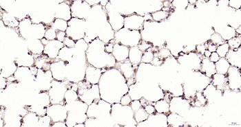 PSME3 Rabbit Polyclonal Antibody