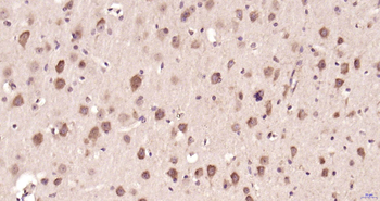 PSME3 Rabbit Polyclonal Antibody
