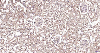PSME3 Rabbit Polyclonal Antibody