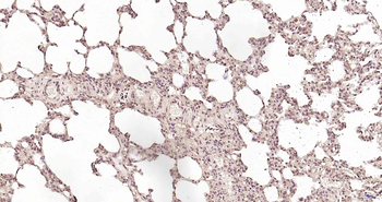 PSME3 Rabbit Polyclonal Antibody