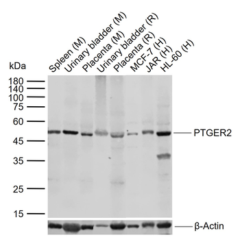 PTGER2 Rabbit Polyclonal Antibody