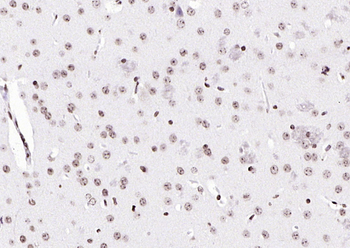 Phospho-B-Raf (Ser602) Rabbit Polyclonal Antibody