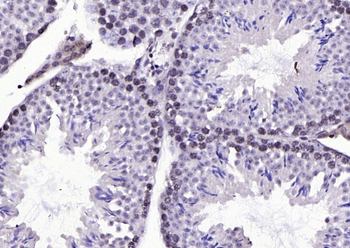 Phospho-B-Raf (Ser602) Rabbit Polyclonal Antibody