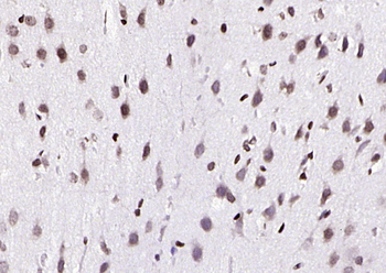 Phospho-B-Raf (Ser602) Rabbit Polyclonal Antibody