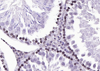 Phospho-B-Raf (Ser602) Rabbit Polyclonal Antibody