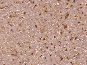 Phospho-BRAF (Ser446) Rabbit Polyclonal Antibody