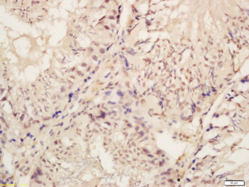 Phospho-BRAF (Ser446) Rabbit Polyclonal Antibody