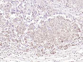 Phospho-BRAF (Thr401) Rabbit Polyclonal Antibody