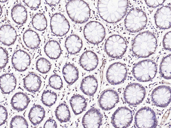 Phospho-BRAF (Thr401) Rabbit Polyclonal Antibody