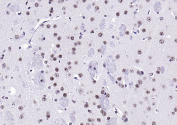 Phospho-BRAF (Thr401) Rabbit Polyclonal Antibody