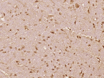 Phospho-BRAF (Thr401) Rabbit Polyclonal Antibody