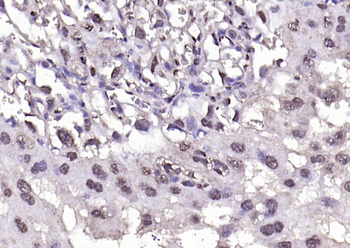 Phospho-BRAF (Thr401) Rabbit Polyclonal Antibody