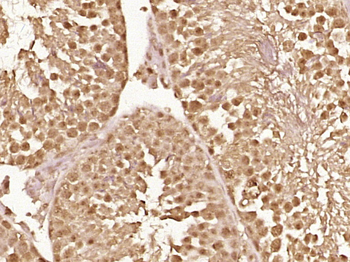 Phospho-BRAF (Thr401) Rabbit Polyclonal Antibody