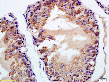 Phospho-BAP1 (Ser592) Rabbit Polyclonal Antibody