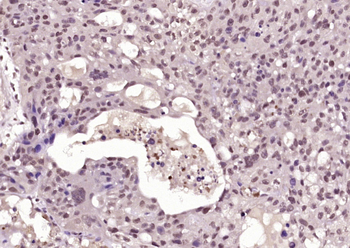 Phospho-BRCA1 (Ser1423) Rabbit Polyclonal Antibody