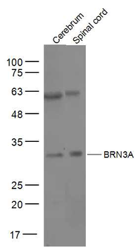 BRN3A Rabbit Polyclonal Antibody