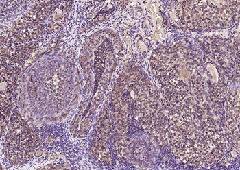 RAD9 Rabbit Polyclonal Antibody