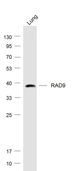 RAD9 Rabbit Polyclonal Antibody